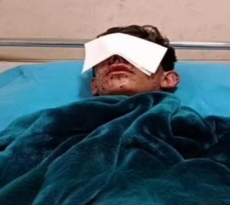آریان ممندی، شهروند کرد یکی از چشمهایش را از دست داد