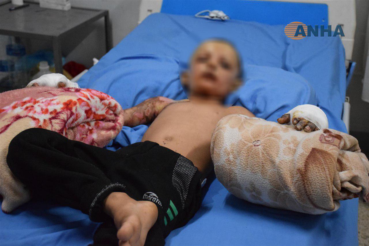 Turkey uses banned weapons against Kurdish civilians including children, say leaders