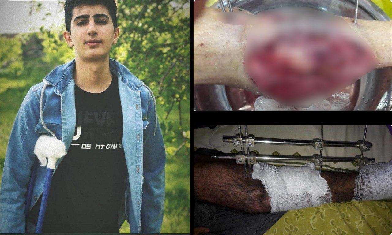 İran rejiminin yaraladığı Husen Elem, 10 aydır zulüm çekiyor