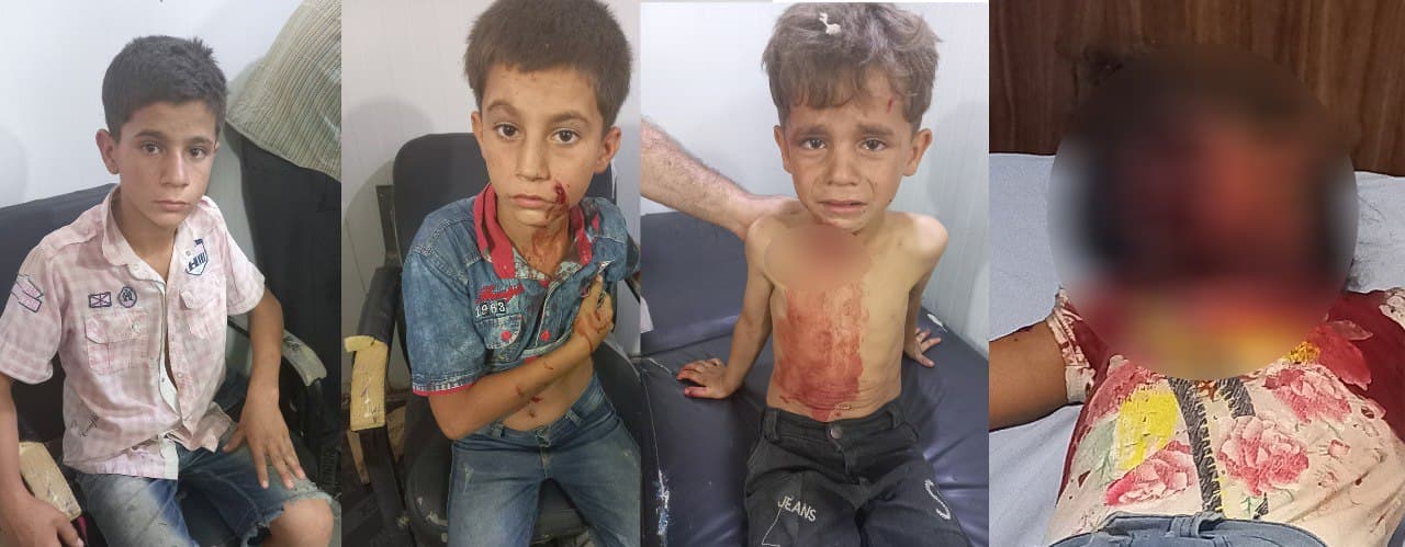 Şehba’da mayın patlaması: 4 çocuk yaralandı