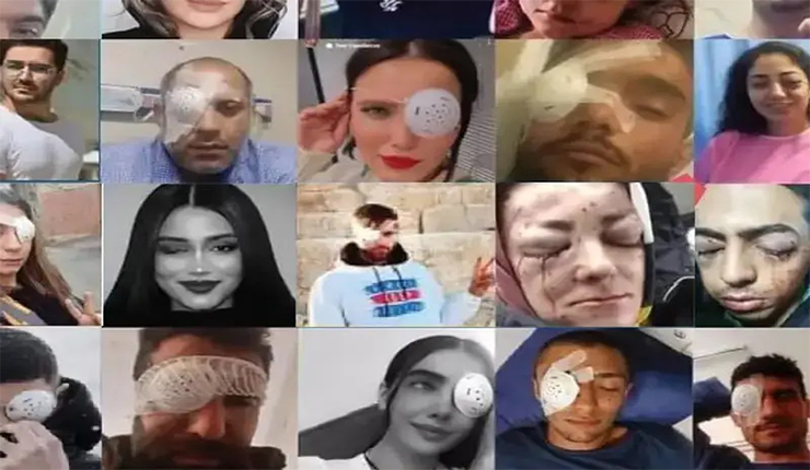 إصابة في العين