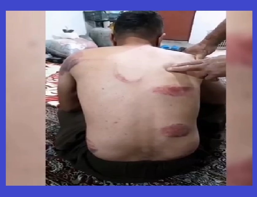 اتحادیه میهنی یک کولبر را بشدت شکنجه کرد