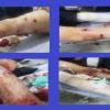 The direct fire of the police injured two Kurdish youths
