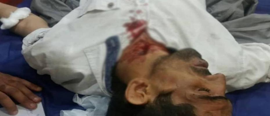 صورة قتيل برصاصة الحرس الثوري