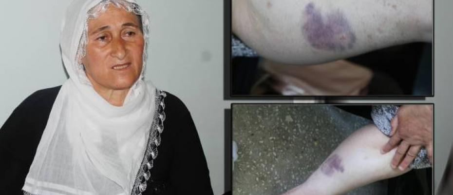 Polisten beyaz tülbentli kadına işkence 