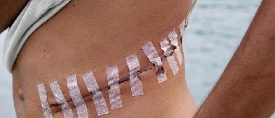 لە ڕۆژئاواى کوردستان میلیشیا و هێزەکانى سەر بە ئێران و تورکیە ئەندامانى جەستەى کوردەکان قاچاخ دەکەن