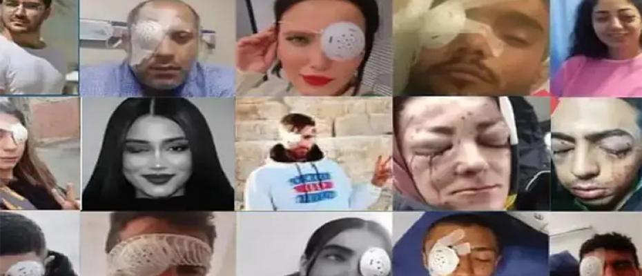 إصابة في العين