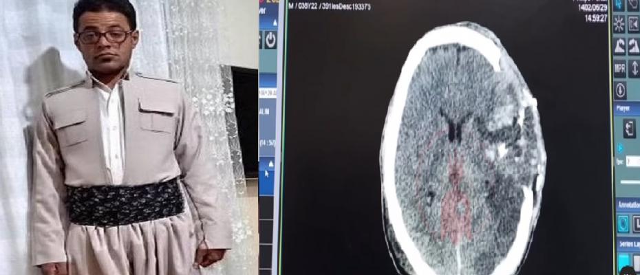 Volunteer doctors of Kurdistan published pictures of Fardin Jafari's brain injury