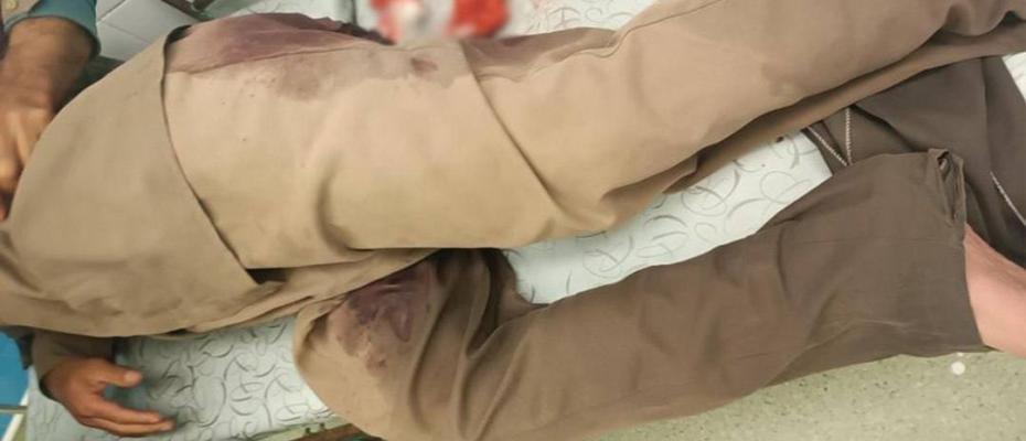A Kolbar was injured by Iranian border forces