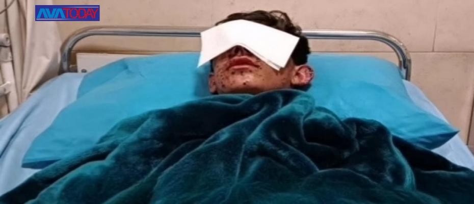 آریان ممندی، شهروند کرد یکی از چشمهایش را از دست داد